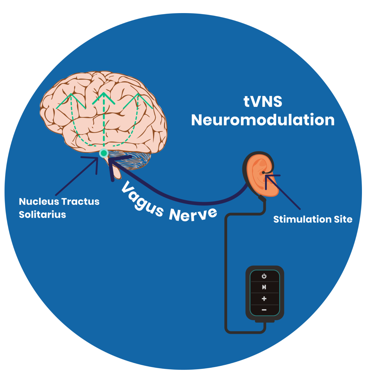 Innovative Neuromodulation Therapy – How tVNS works