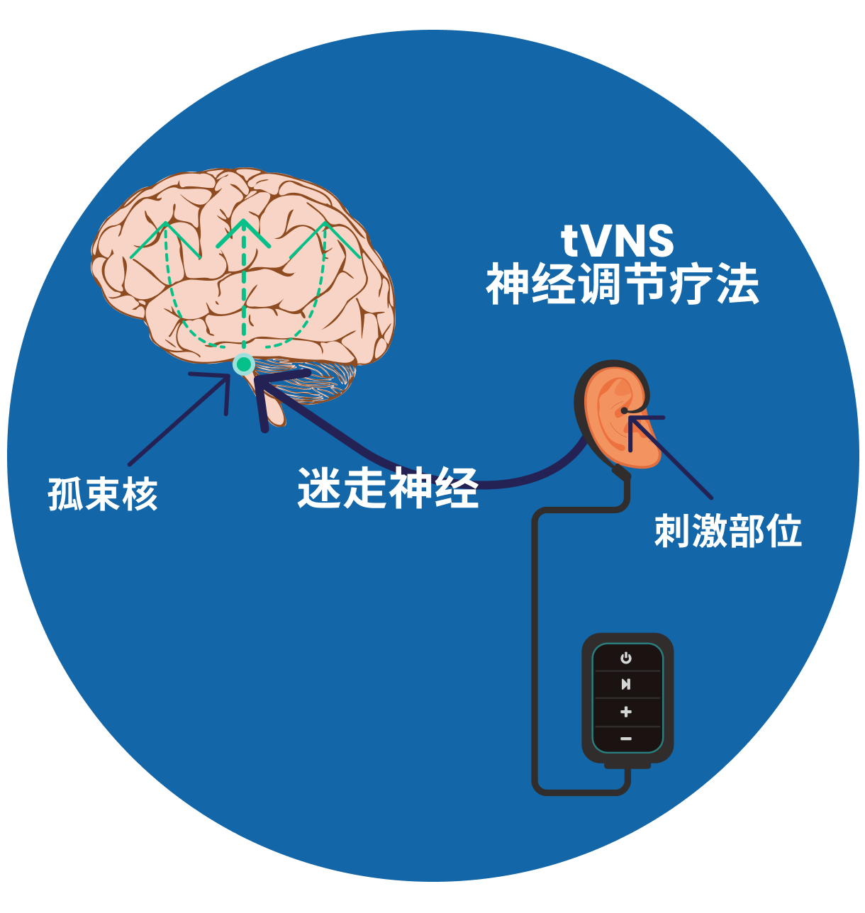 tVNS 的治疗原理——创新的神经调节疗法