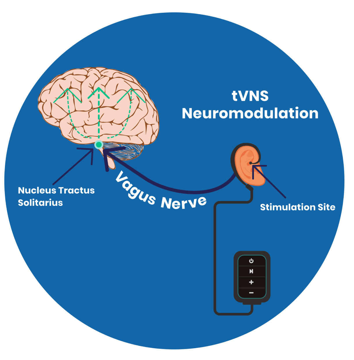 The Neural Mechanisms of Transcutaneous Vagus Nerve Stimulation (tVNS)